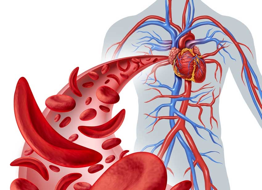 Hipertensiunea arteriala: cauze si tratament